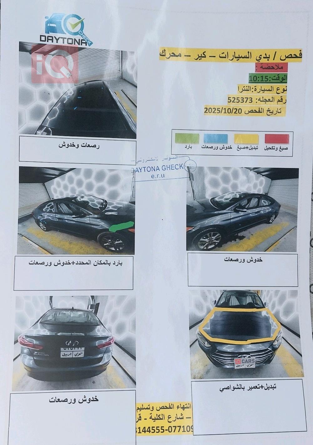 هيونداي النترا